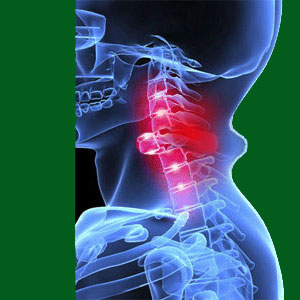 Grade 4 Spondylolisthesis