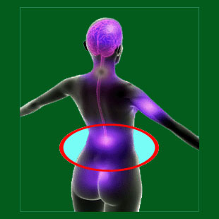 Misdiagnosed spondylolisthesis