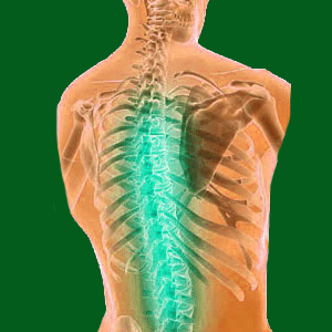 Natural Spondylolisthesis Treatment