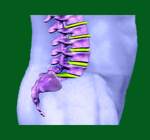 Psychosomatic Spondylolisthesis Pain