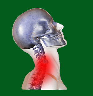 Spondylolisthesis C5