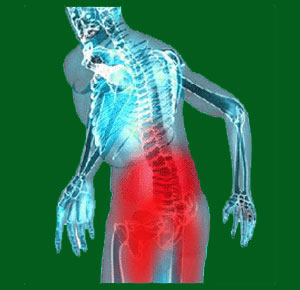 Spondylolisthesis disability