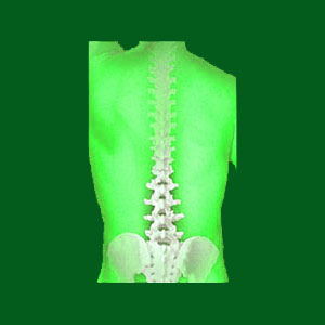 spondylolisthesis exercises