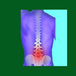 spondylolisthesis facts