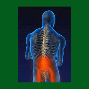 Spondylolisthesis Home Remedy