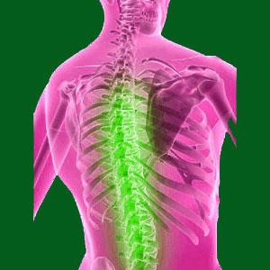 Spondylolisthesis Hypolordosis