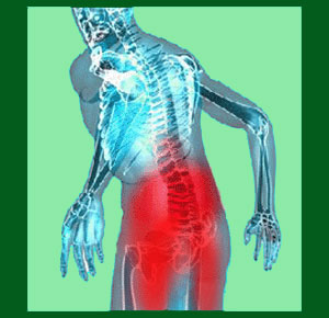 Spondylolisthesis Incontinence