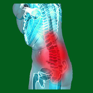 Spondylolisthesis from injury