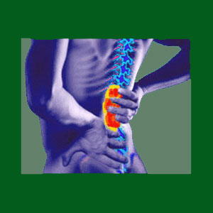 Spondylolisthesis L4