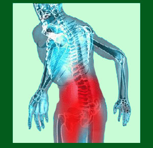 Spondylolisthesis Lower Back Pain