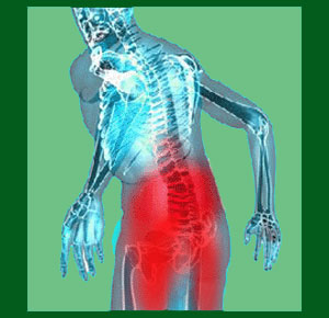 Spondylolisthesis pain management