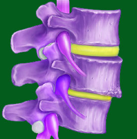 Spondylolisthesis Relief