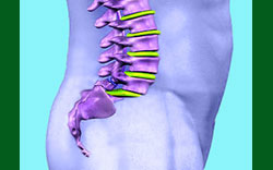 vertebral listhesis